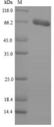SDS-PAGE (PNPLA2-1333H).jpg